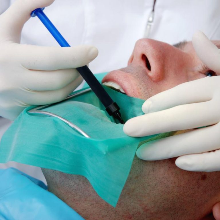 root-canal